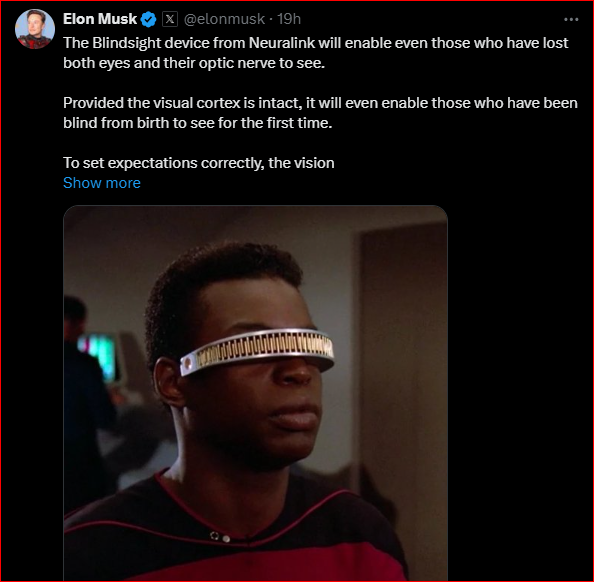 Elon Musk Invents A Device That Will Enable The Blind To See.PNG