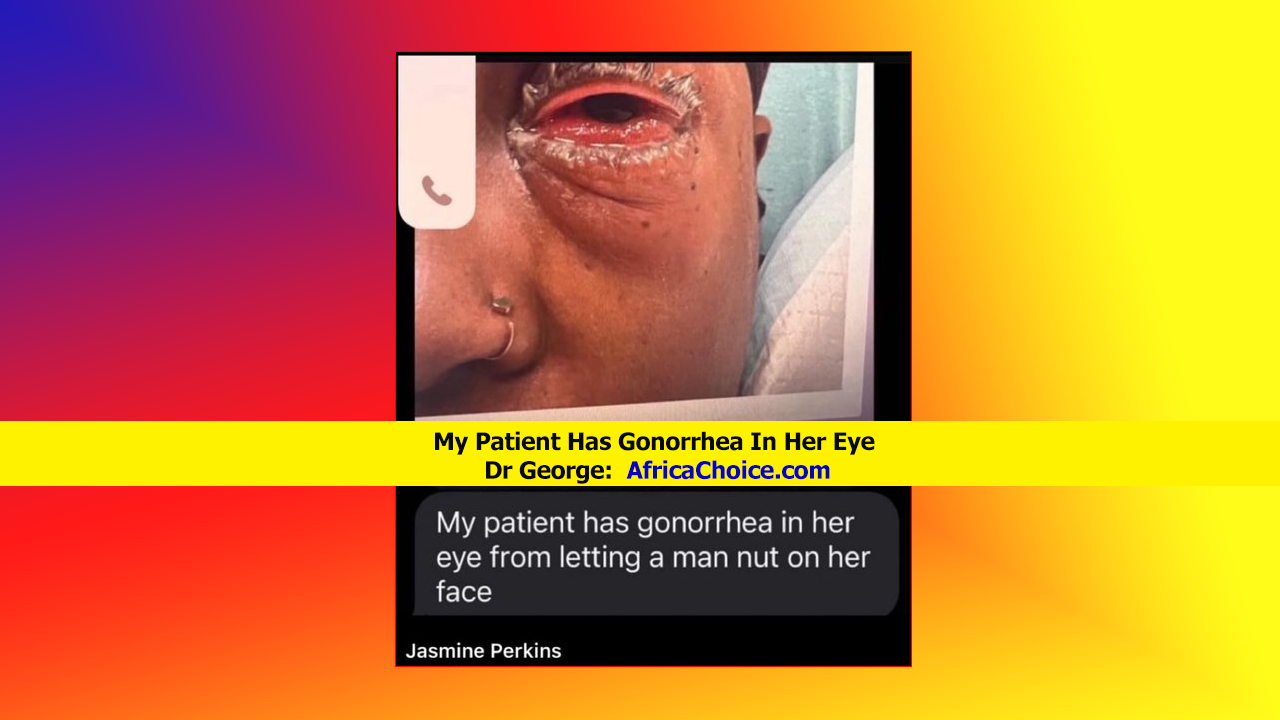 My-Patient-Has-Gonorrhea-In-Her-Eye-Dr-George,-AfricaChoice.png