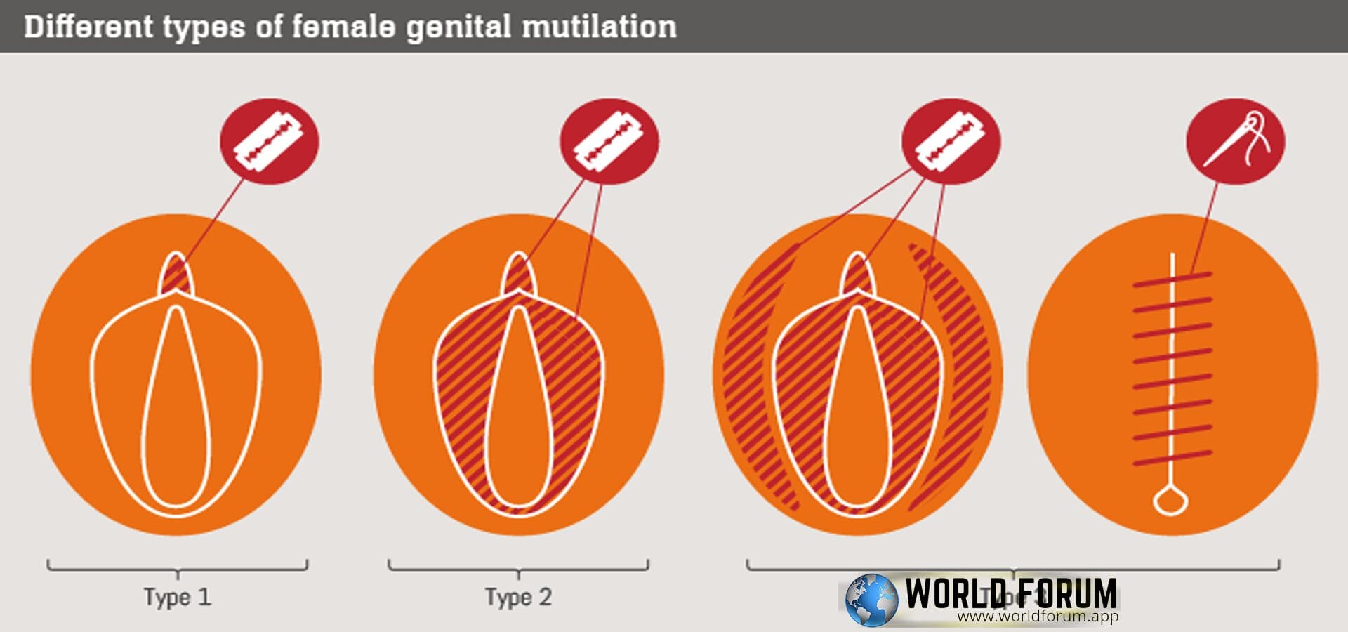 Problems-of-Female-Genital-Mutilation.jpg